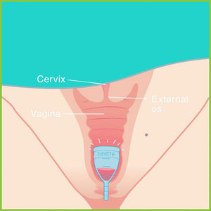 An image showing how a menstrual cup sits inside a vagina.